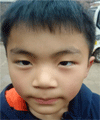 李宇哲