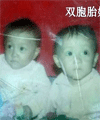 寻找1995年出生送养双胞胎